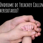 Síndrome de Treacher Collins