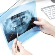 ¿Qué es la Radiología Dental?