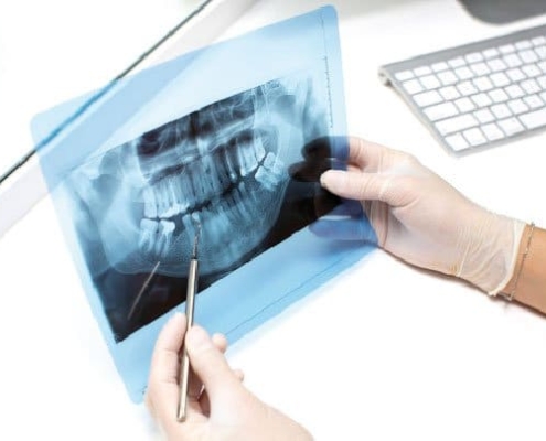 ¿Qué es la Radiología Dental?