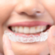 ¿Cubren los seguros dentales Invisalign?