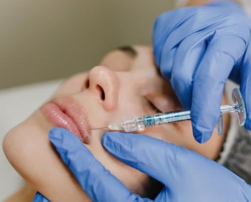 Lipofilling de labios