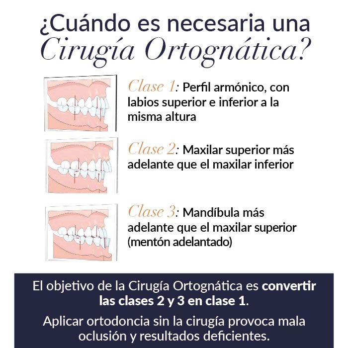 Operación de Cirugía Ortognática