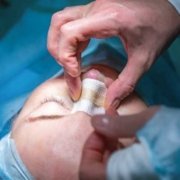 Tratamientos estéticos para la nariz con septoplastia