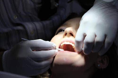 Injerto de hueso dental