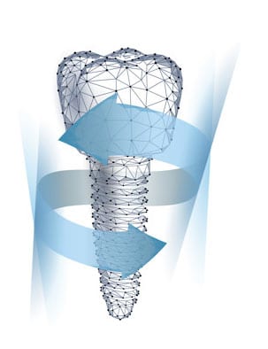 Periimplantitis