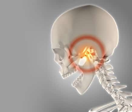 Disfunción de la articulación temporomandibular