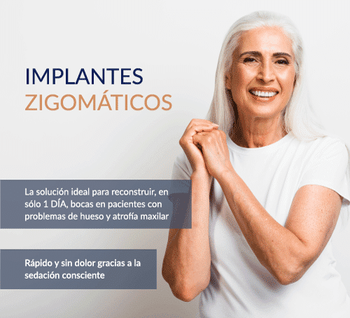 Implantes cigomáticos opiniones