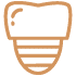 Tipos de implantes dentales