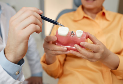 Implantes dentales sin hueso precios