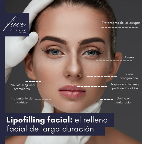 Lipofilling facial Madrid