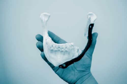Prótesis faciales para corregir deformidades maxilofaciales