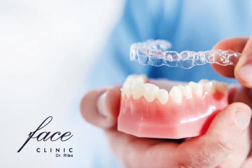 Invisalign Valladolid precio