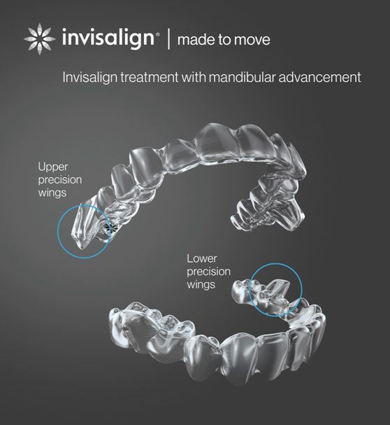 Invisalign® con Avance Mandibular