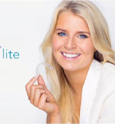 Invisalign Lite
