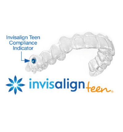 Invisalign Teen
