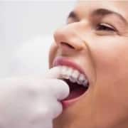 ¿qué es férula dental?